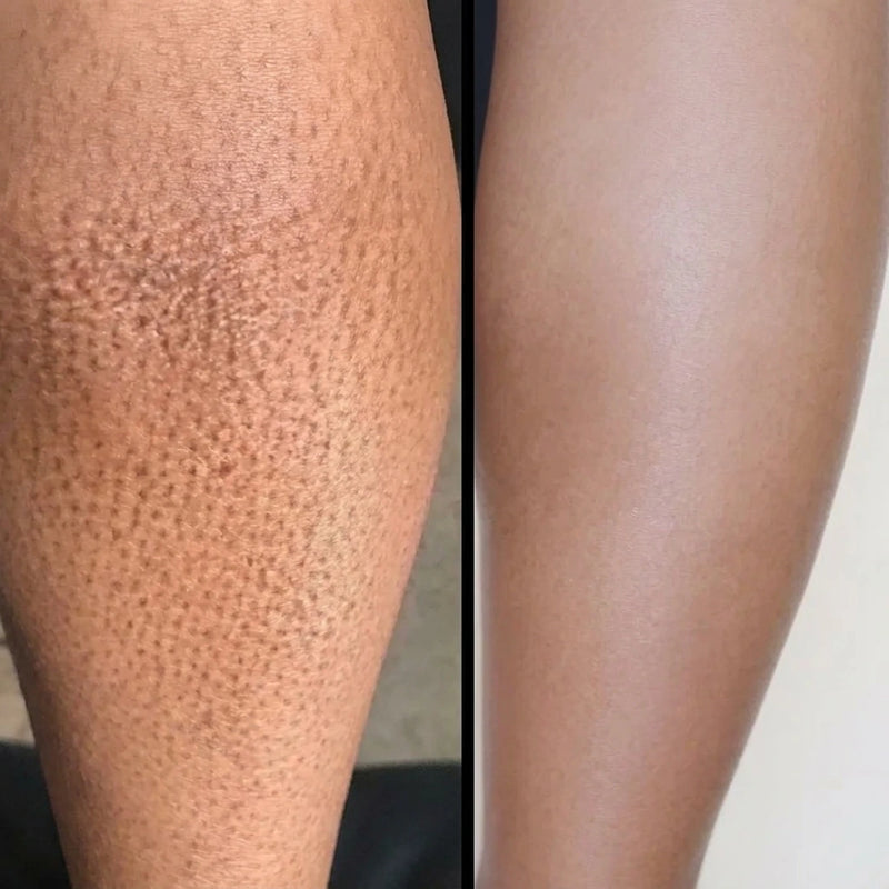 Piernas suaves
