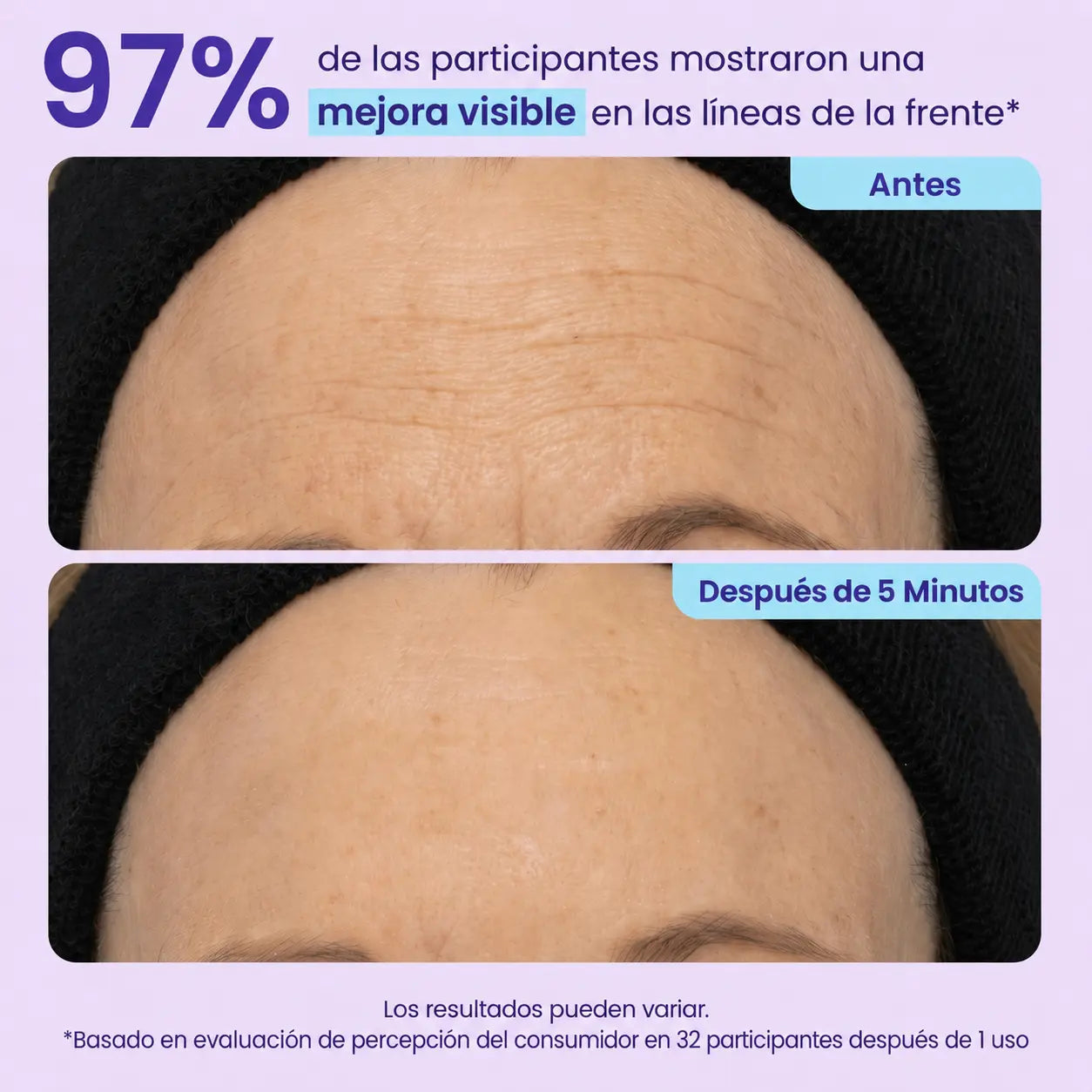 Gel Lifting Instantáneo – Adiós Ojeras, Bolsas y Arrugas