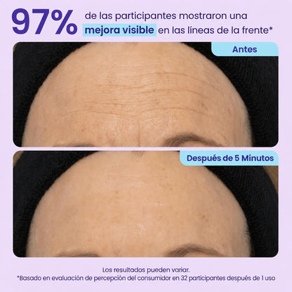 Gel Lifting Instantáneo – Adiós Ojeras, Bolsas y Arrugas