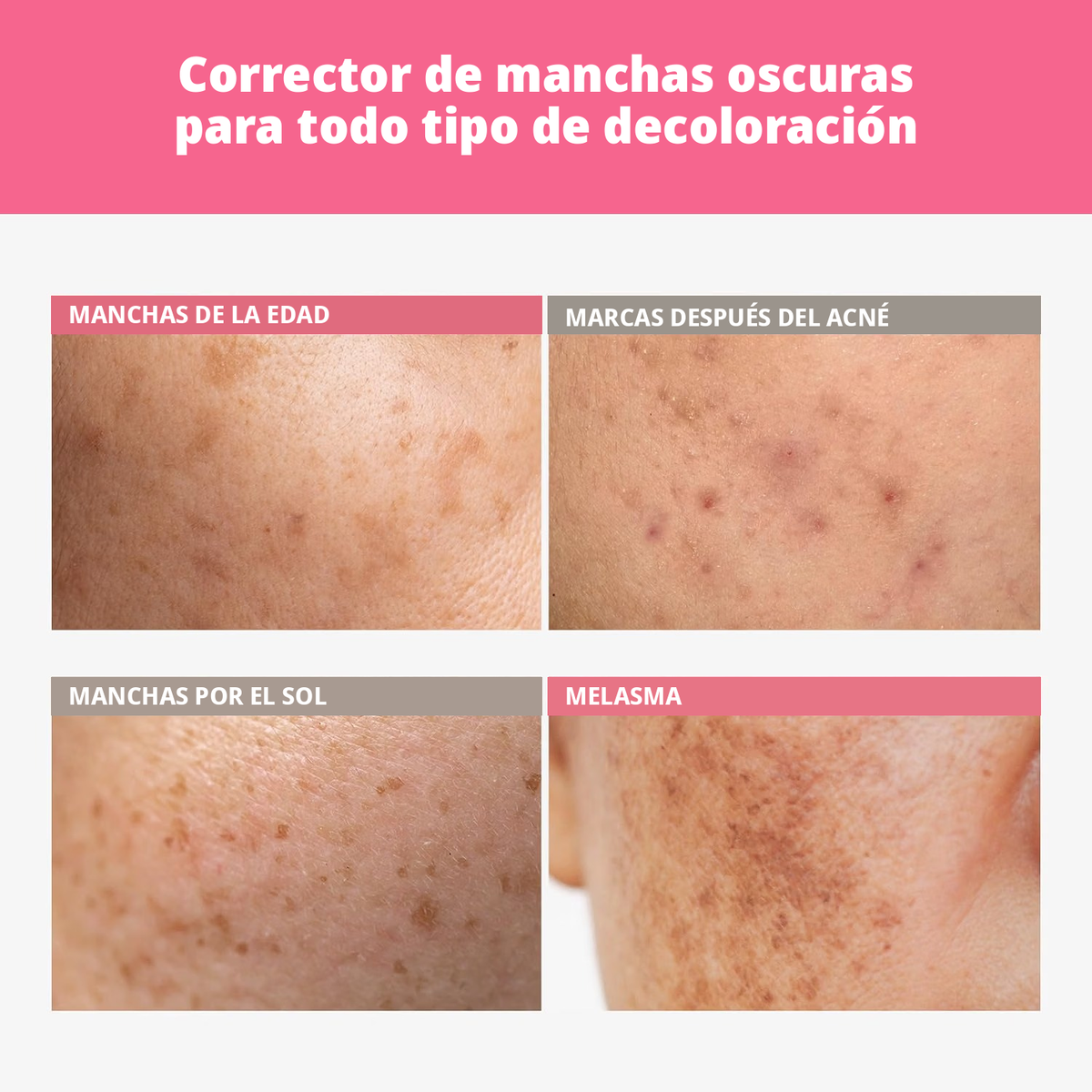 TOSOWOONG Arbutin 7.0 + TXA 4.0 Crema