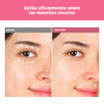 TOSOWOONG Arbutin 7.0 + TXA 4.0 Crema
