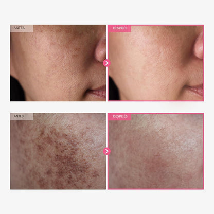 TOSOWOONG Arbutin 7.0 + TXA 4.0 Crema